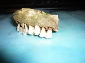 Zuby-pomoc pri identifikácii - diskusia