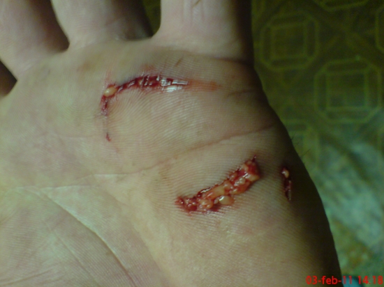 Takto dopadnete ked mate psov ako britva.