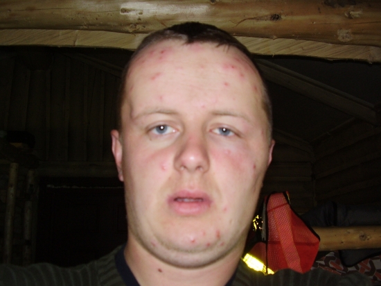 čo dokažu urobit moskyti....