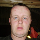 čo dokažu urobit moskyti....
