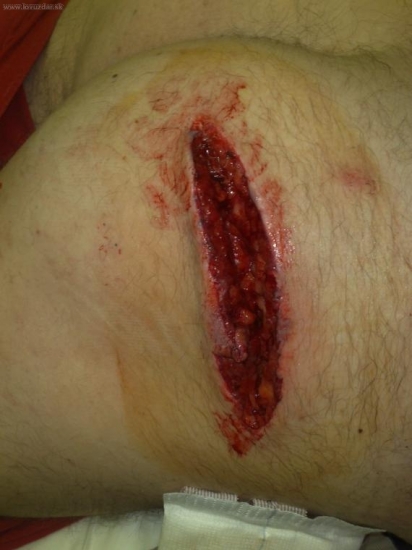 Dnes napadol kanec honca na spolocnej na drobnu.