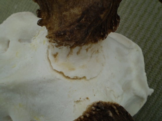 Daniel - zranenie lebky