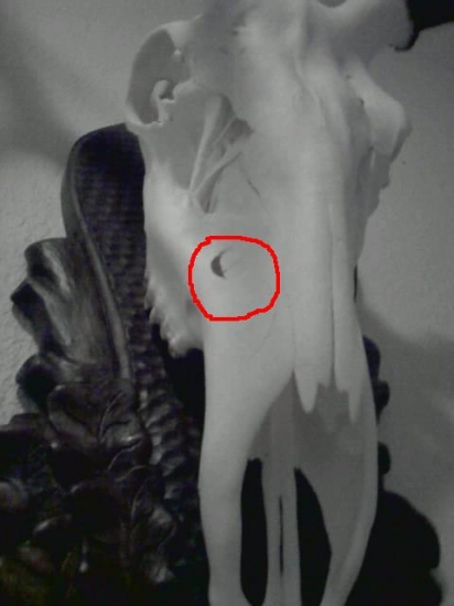 Rana ktora mu ostala z ruje