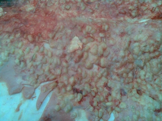 podkožná strečkovitosť