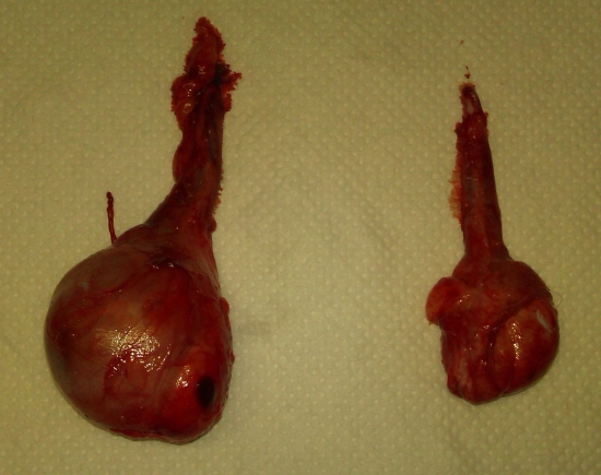 PREVENTIVNE ZOPEROVANE VARALATA V ZACIATKOCH NADOROVEHO BUJNENIA .