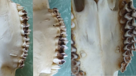 Čo mohlo spôsobiť takýto abnormálny chrup ??