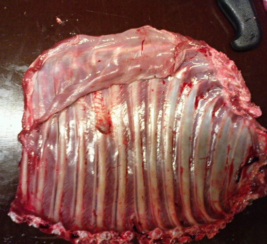 zrastené zlomené rebro