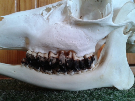 Je toto Aktinomykóza?