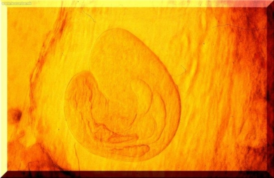 Mezocerkária Alaria alata