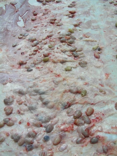 podkožná strečkovitost